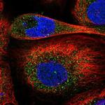 DIXDC1 Polyclonal Antibody