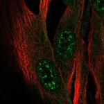 ZCWPW2 Polyclonal Antibody