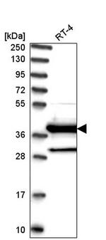 DNAJC22 Antibody in Western Blot (WB)