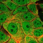 DYNLL1 Polyclonal Antibody