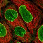 EIF2B4 Polyclonal Antibody