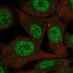 PAAF1 Polyclonal Antibody