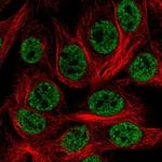 HOXD1 Antibody in Immunocytochemistry (ICC/IF)