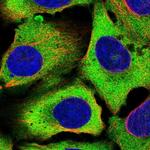 eIF5B Polyclonal Antibody