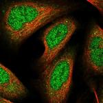 RhoBTB1 Polyclonal Antibody