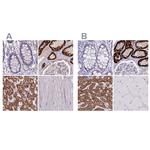 GLYAT Polyclonal Antibody