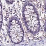 GLYAT Antibody in Immunohistochemistry (IHC)