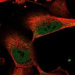 FANCI Antibody in Immunocytochemistry (ICC/IF)