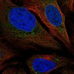 TMEM66 Polyclonal Antibody