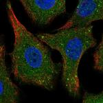 SPG21 Polyclonal Antibody