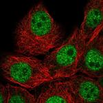 IAH1 Polyclonal Antibody