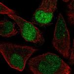 AQR Polyclonal Antibody