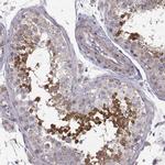 Ccdc89 Antibody in Immunohistochemistry (IHC)