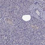 Ccdc89 Antibody in Immunohistochemistry (IHC)