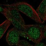 Ccdc89 Antibody in Immunocytochemistry (ICC/IF)