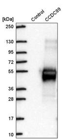 Ccdc89 Antibody in Western Blot (WB)