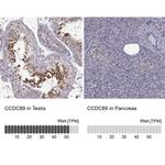 Ccdc89 Antibody