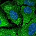 CaMKII gamma Polyclonal Antibody