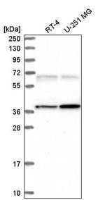 CaMKII gamma Antibody in Western Blot (WB)