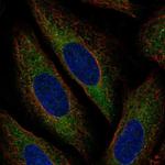 TEB4 Polyclonal Antibody