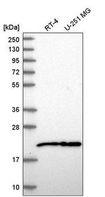 NIP7 Antibody in Western Blot (WB)