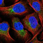 FUT8 Polyclonal Antibody