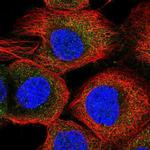 ACOT11 Polyclonal Antibody