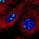 DDX18 Polyclonal Antibody