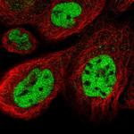 CCNDBP1 Polyclonal Antibody