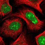 KIAA1310 Polyclonal Antibody