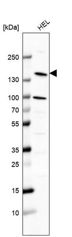 PLCB2 Antibody in Western Blot (WB)