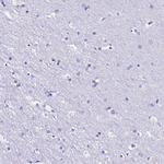 RBP3 Polyclonal Antibody