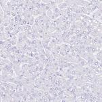 RBP3 Antibody in Immunohistochemistry (Paraffin) (IHC (P))