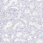 RBP3 Antibody in Immunohistochemistry (IHC)