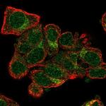 TXNL4A Polyclonal Antibody