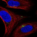 SPATA25 Polyclonal Antibody