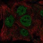 INO80 Polyclonal Antibody