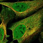 FBXO38 Polyclonal Antibody