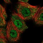 CNOT10 Polyclonal Antibody