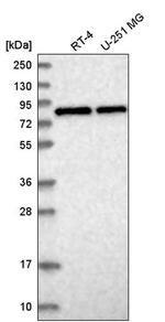 CNOT10 Antibody in Western Blot (WB)