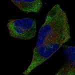 TRIM9 Polyclonal Antibody