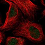 ANKRD11 Polyclonal Antibody