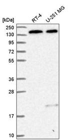 DHX38 Antibody in Western Blot (WB)