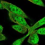 ZNF407 Polyclonal Antibody