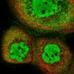 PHF22 Polyclonal Antibody