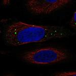 IGIP Polyclonal Antibody