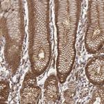 ZFYVE19 Polyclonal Antibody