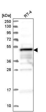 ZFYVE19 Antibody in Western Blot (WB)