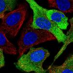 CPPED1 Polyclonal Antibody