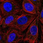 ITPRIPL2 Polyclonal Antibody